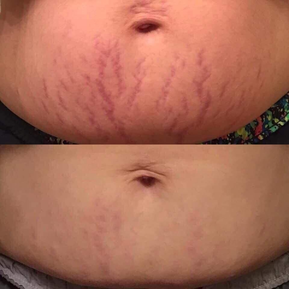 Body Butter Skin Cream